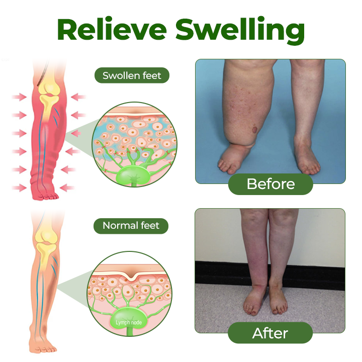 Timilk®Professional Leg Circulation Cream⭐