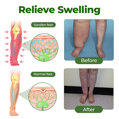 Timilk®Professional Leg Circulation Cream⭐