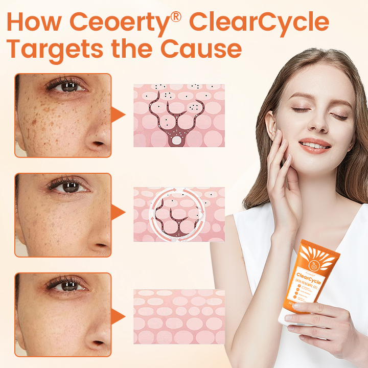 Ceoerty® ClearCycle Skin Renewal Gel