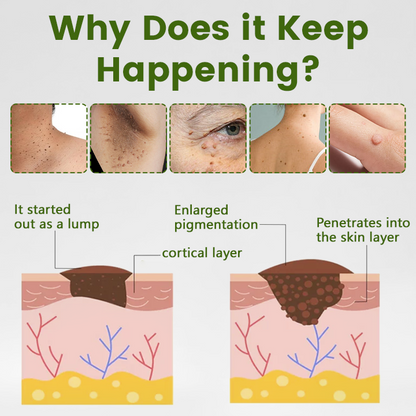 Timilk® ThujaClear Botanical Wart Cream