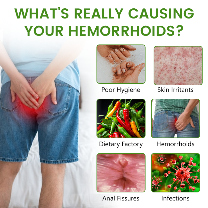 Timilk® Advanced Hemorrhoid Healing Cream.