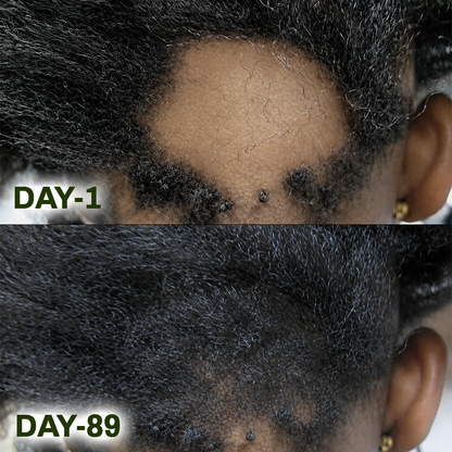 Ceoerty® Batana Natural Hair Growth Oil