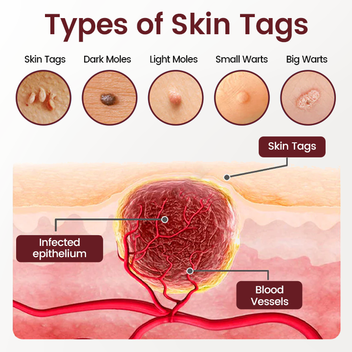 Timilk® BumpAway Gentle Renewal Cream