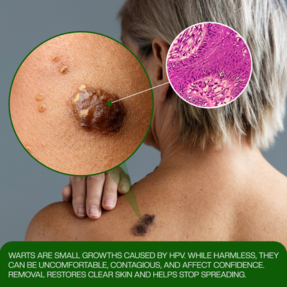 Timilk® ClinixClear Wart Remover Patch⭐