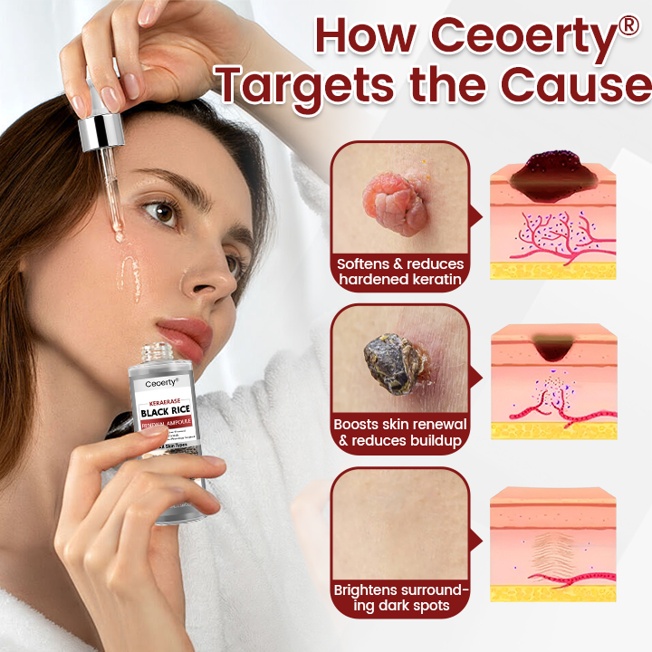 Ceoerty® KeraErase Black Rice Renewal Ampoule