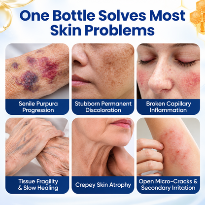 Timilk® VenoRescue Bee Venom Bruise & Skin Recovery Spray