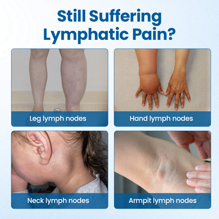 Timilk® Lymphora Swelling Relief Roll-On⭐