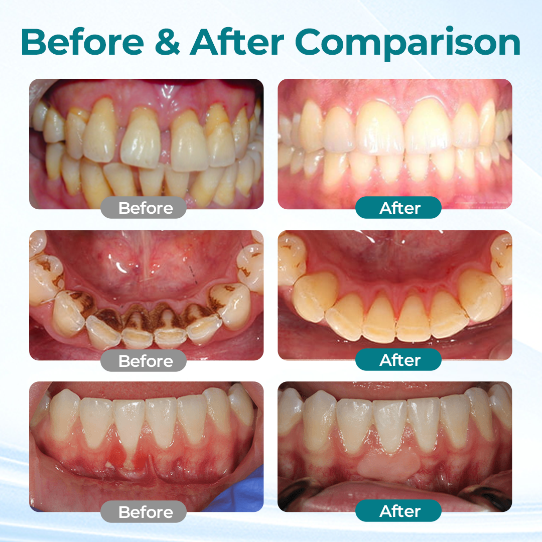 Biancat® DentaRevive Enamel & Gum Repair Foam