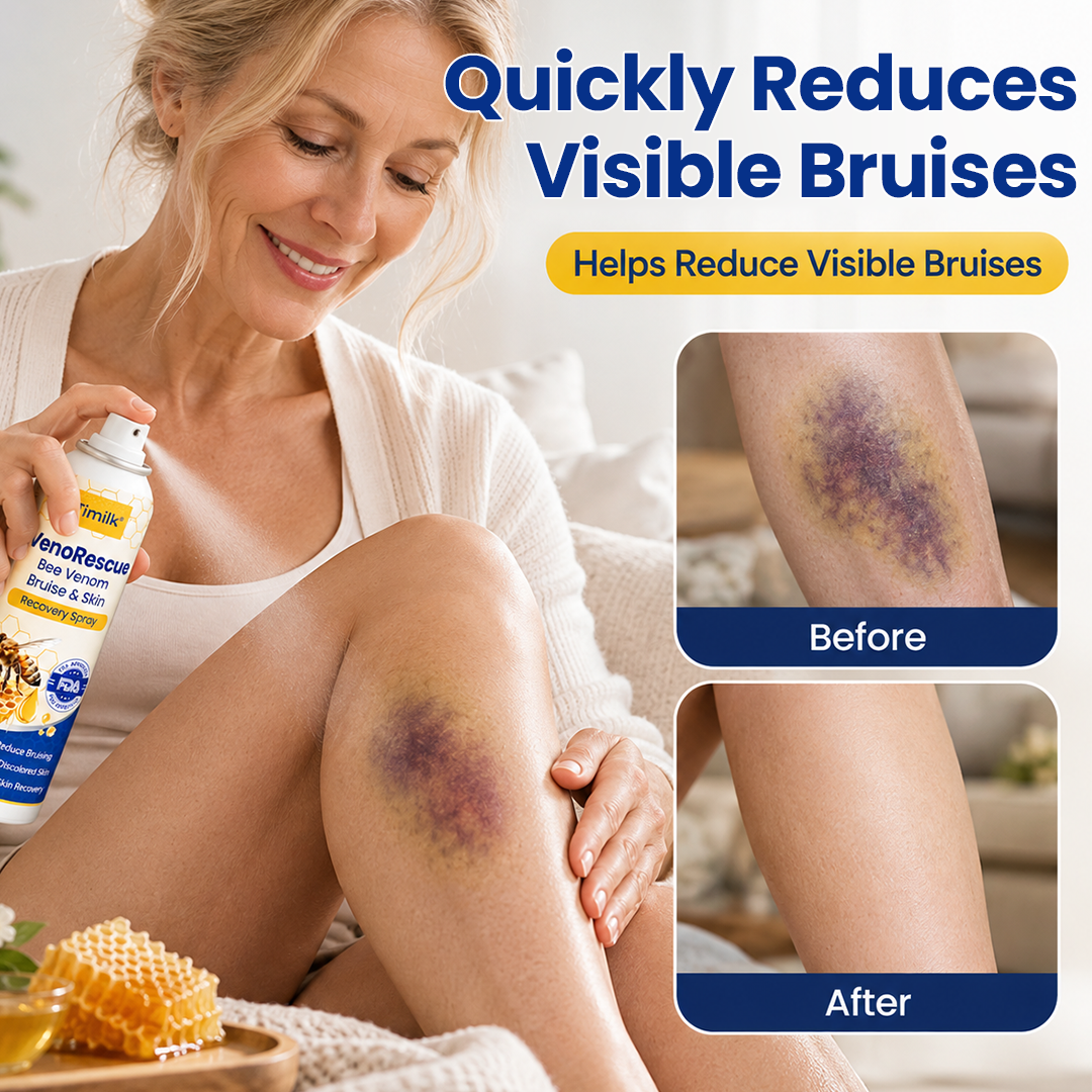 Timilk® VenoRescue Bee Venom Bruise & Skin Recovery Spray