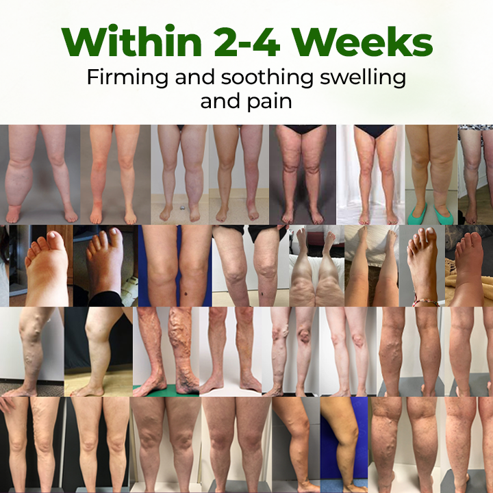 Timilk®Professional Leg Circulation Cream⭐