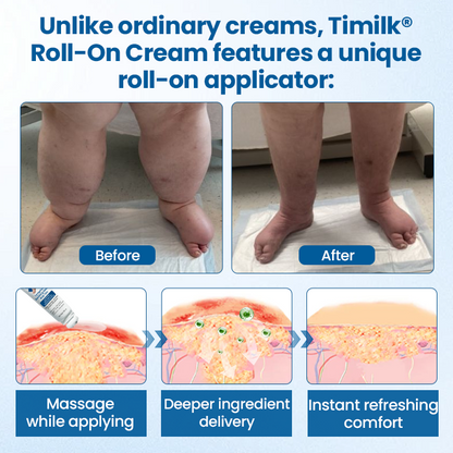 Timilk® Lymphora Swelling Relief Roll-On⭐