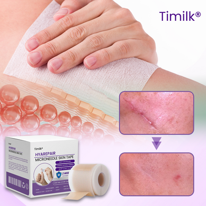 Timilk® HyaCare Skin Patch⭐